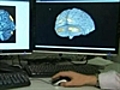 Brain scan locates source of anxiety