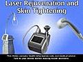 Lasers and Your Skin