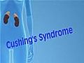 Cushing Disease