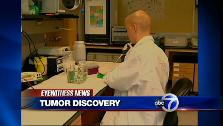 VIDEO: New treatment for brain tumors