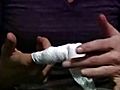 Mom Has Finger Bitten Off In Bar Fight