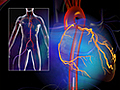 What Is a Coronary Angiography?