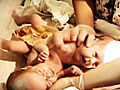 Separated Twins - Cojoined Twins Webisodes: Separated Twins