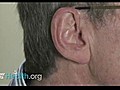 Buying Hearing Aids