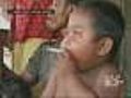 Smoking Toddler In Indonesia Kicks Habit