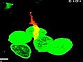 Cure clues from cancer cell close-up