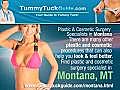 Tummy Tuck Montana