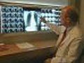 New Lung Cancer Drug Shows Promise