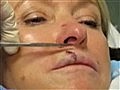 Weird News - Ouch! Martha Stewart Gets Stitches in Upper Lip