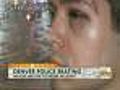Image Shows Man’s Face After Alleged DPD Beating