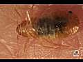 Animals: Bed Bugs on the Rise