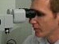 Low HDL Levels Could Lead to Macular Degeneraiton