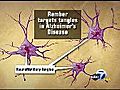 New drugs give hope to Alzheimer’s