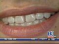 &quot;Invisible&quot; Braces for Teens