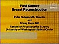 Post Cancer Breast Reconstruction