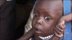 Watch                                     UN voices fears of Africa famine