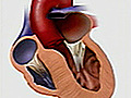 Hypertrophic Cardiomyopathy