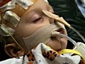 GMA 12/14: 2-Year-Old’s Miraculous Survival