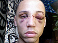 26-Year-Old Man Beat Down Outside A NY McDonalds Because He’s Gay!