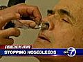 Cancer drug helps stop nosebleeds