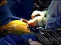 Robotic Surgery