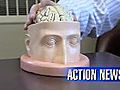 VIDEO: Local specialist weighs in on brain injuries