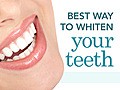 Best Way to Whiten Your Teeth