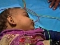 Libya: Injured baby dispute