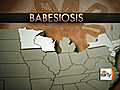 Babesiosis: Illness ticks spread on the rise