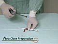 NeatStich- device for laparoscopic surgery