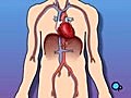 Cardiac Catheterization Angiograph