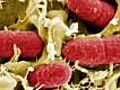 ¿Cómo se contagia la bacteria E. coli?