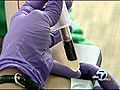 SF at forefront of Hepatitis B screenings