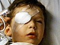 Surgeon Operates on Wrong Eye of 4-Year-Old Boy