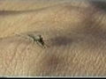 West Nile blamed for 14 deaths in Greece