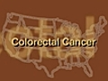 Colon Cancer in African-Americans