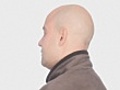 Bald spinning head