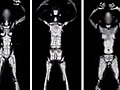 TSA Installs Full-Body Scanners