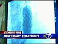 Less invasive approach to heart valve replacement
