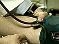 Many Americans Have High Blood Pressure