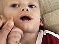 The Boy Who Bit Himself - Mystery Diagnosis Webisodes: Mystery Diagnosis: The Boy Who Bit Himself