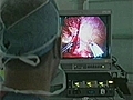 Laparoscopic Surgery