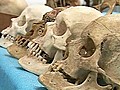 Man Found Dead in House Full of Skeletons,  Bones