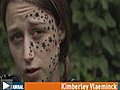 Une jeune femme prétend avoir été tatouée de 56 étoiles sur le visage à son insu