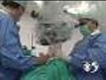 5/10: Reducing The Risk Of Stomach Cancer