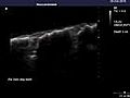 Ex-vivo spine in Mechanical Testing