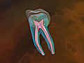 What Happens During a Root Canal?