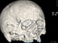 Brain Scan: Court Evidence