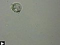 L’aspidisca,  protozoaire cilié