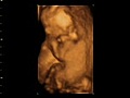4D baby scan 16 17 18 week baby playing in the womb